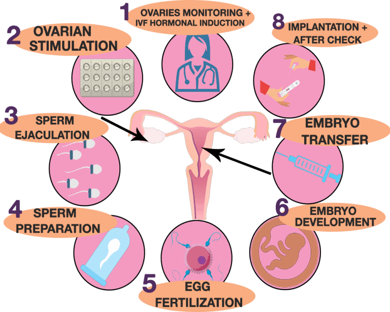 Illustration of IVF stages from ovarian monitoring and stimulation through fertilization, embryo development, transfer and follow-up