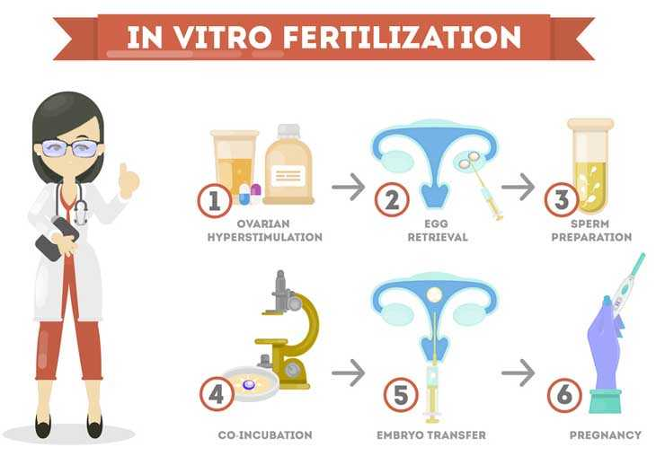 Illustration showing stages of an IVF treatment process, from ovarian stimulation to pregnancy