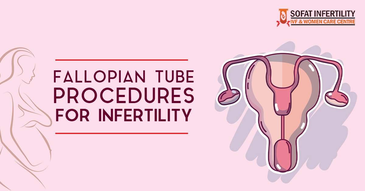 Tubal Factor Infertility: Everything you need to know about Fallopian Tube Obstruction