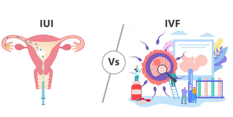 IVF Treatment VS IUI Treatment: which one to go for?