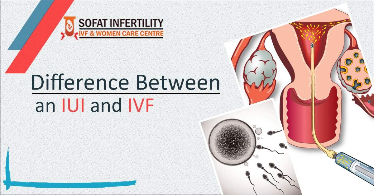 Infertility Treatment-: What is the difference between an IUI and IVF?