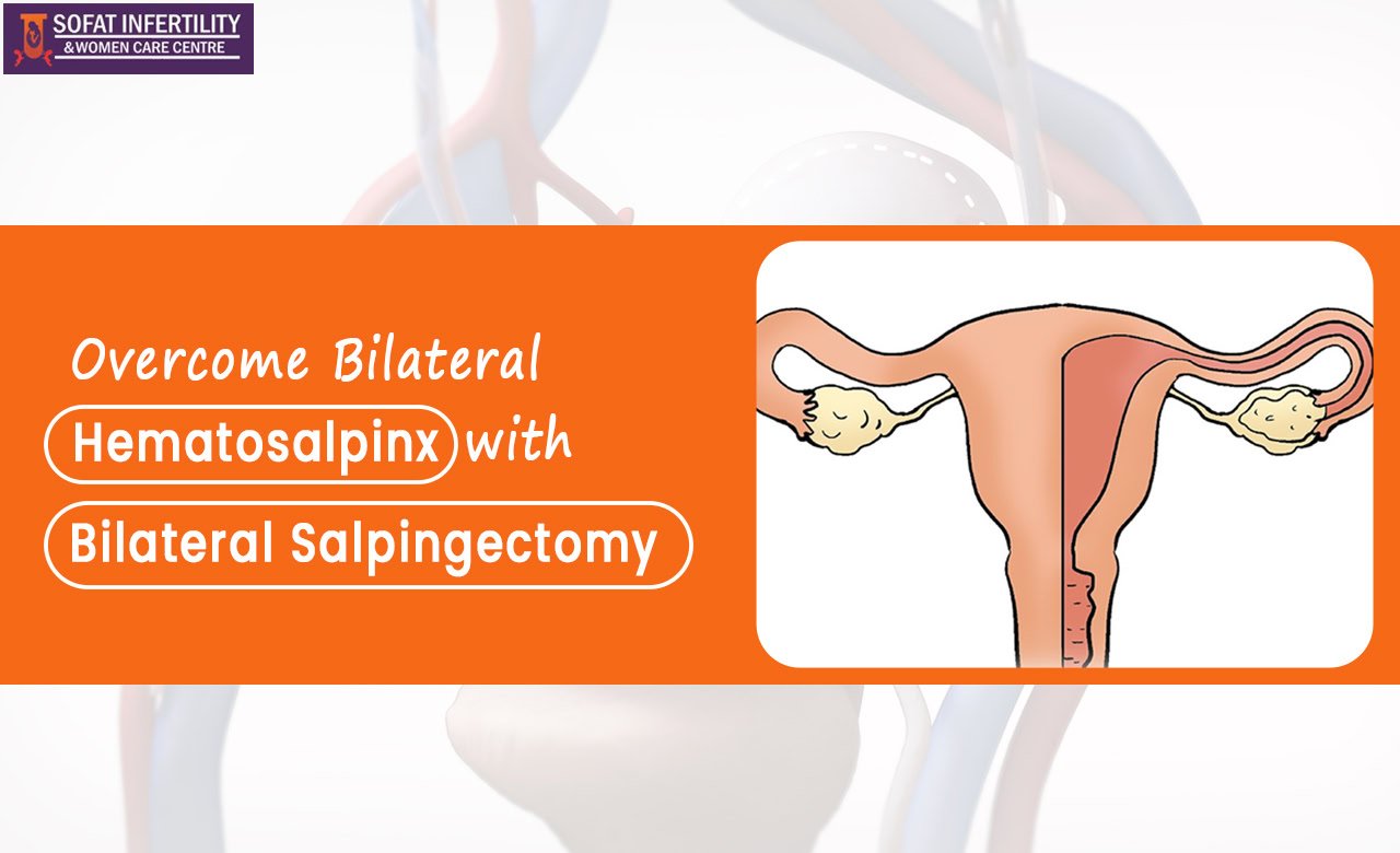 Overcome Bilateral Hematosalpinx with Bilateral Salpingectomy