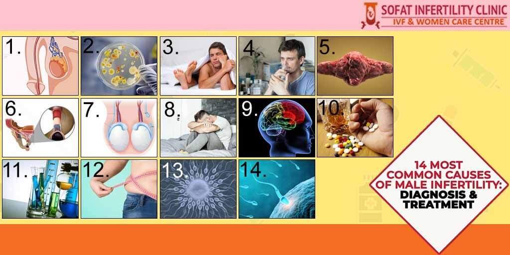 14 Most Common Causes of Male Infertility: Diagnosis & Treatment