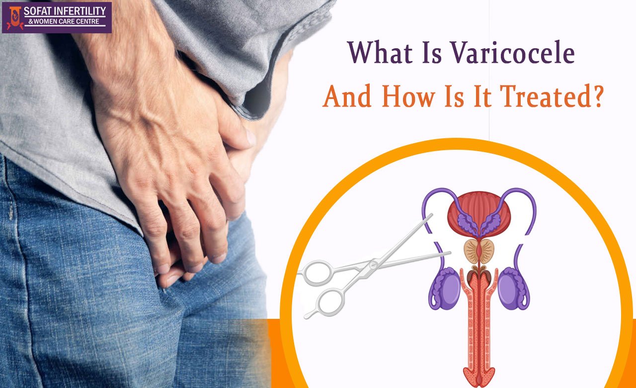 Varicocele: Its Symptoms, Diagnosis and Treatments
