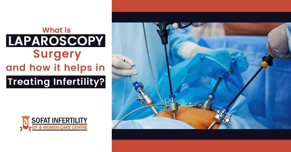 What is Laparoscopy surgery and how it helps in treating infertility?