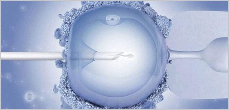 ICSI Treatment, Infertility and Cost in India