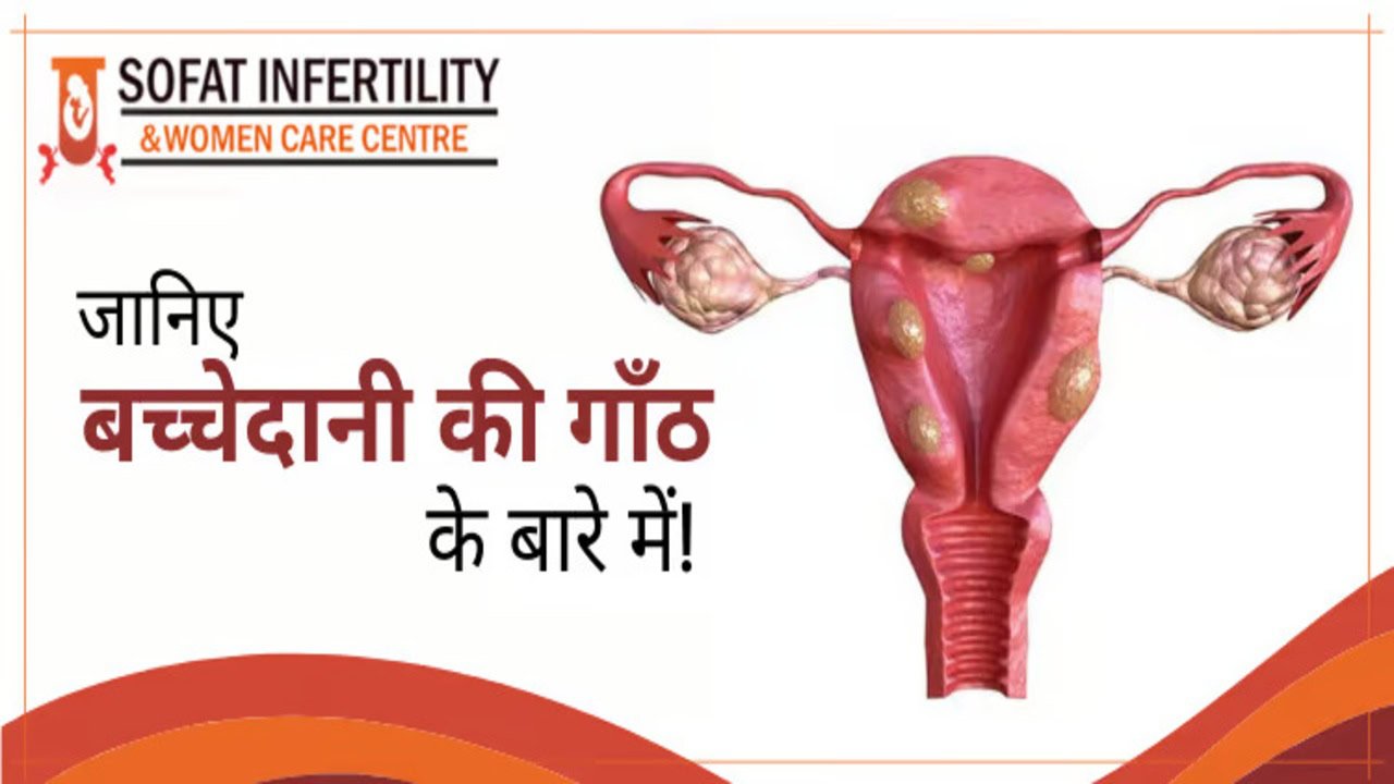 बच्चेदानी में गाँठ उतपन्न होने के क्या कारण और लक्षण होते है? कोनसे फैक्टर्स इसका इलाज निर्धारित करवाने में सहायी होते है?