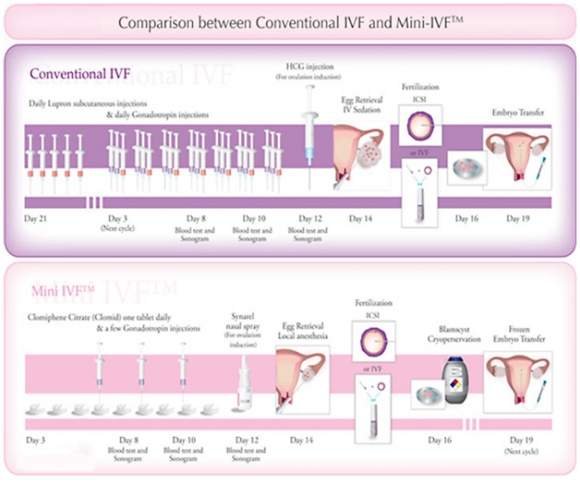 Mini IVF