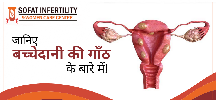 महिलाओं के अंडाशय में किन कारणों बनता है गांठ, इसके प्रमुख लक्षण और कैसे किया जाता है इलाज ?